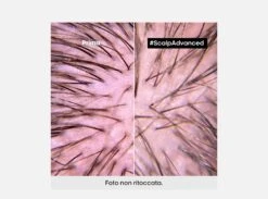 L'Oréal Professionnel Serie Expert Scalp Advanced Trattamento Anti-Discomfort Cute Sensibile 200ml