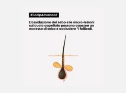 L’Oreal Professionnel Serie Expert Scalp Advanced 2-in-1 Deep Purifier Clay Anti-Oiliness Cute Grassa 250ml | 500ml -Cosmetici Promozione scalp advanced 2 in 1 deep purifier clay anti oiliness l oreal sconto